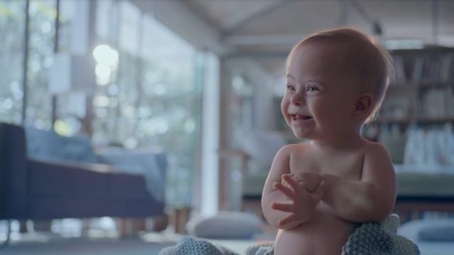 Bebê Johnson's com Síndrome de Down